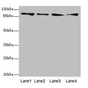 Western blot All lanes: TNNI3K antibody at 4.77ug/ml Lane 1: Hela whole cell lysate Lane 2: Mouse heart tissue Lane 3: HepG2 whole cell lysate Lane 4: Jurkat whole cell lysate Secondary Goat polyclonal to rabbit IgG at 1/10000 dilution Predicted b...