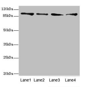 Western blot All lanes: TNNI3K antibody at 4.77ug/ml Lane 1: Hela whole cell lysate Lane 2: Mouse heart tissue Lane 3: HepG2 whole cell lysate Lane 4: Jurkat whole cell lysate Secondary Goat polyclonal to rabbit IgG at 1/10000 dilution Predicted b...