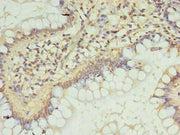 Immunohistochemistry of paraffin-embedded human small intestine tissue using CSB-PA701732LA01HU at dilution of 1:100