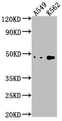 Western Blot Positive WB detected in: A549 whole cell lysate, K562 whole cell lysate All lanes: NKAPL antibody at 1:1000 Secondary Goat polyclonal to rabbit IgG at 1/50000 dilution Predicted band size: 47 kDa Observed band size: 47 kDa