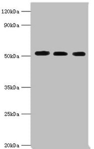 Western blot All lanes: Programmed cell death protein 4 antibody at 5ug/ml Lane 1: Hela whole cell lysate Lane 2: MCF-7 whole cell lysate Lane 3: Jurkat whole cell lysate Secondary Goat polyclonal to rabbit IgG at 1/10000 dilution Predicted band s...