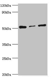 Western blot All lanes: Programmed cell death protein 4 antibody at 4ug/ml Lane 1: Hela whole cell lysate Lane 2: MCF-7 whole cell lysate Lane 3: Jurkat whole cell lysate Secondary Goat polyclonal to rabbit IgG at 1/10000 dilution Predicted band s...