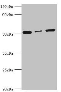 Western blot All lanes: Programmed cell death protein 4 antibody at 4ug/ml Lane 1: Hela whole cell lysate Lane 2: MCF-7 whole cell lysate Lane 3: Jurkat whole cell lysate Secondary Goat polyclonal to rabbit IgG at 1/10000 dilution Predicted band s...