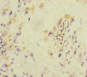 Immunohistochemistry of paraffin-embedded human placenta tissue using CSB-PA703614ESR1HU at dilution of 1:100