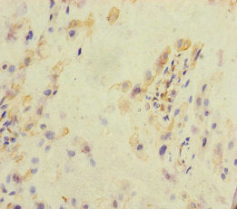 Immunohistochemistry of paraffin-embedded human placenta tissue using CSB-PA703614ESR1HU at dilution of 1:100