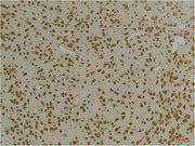 Immunohistochemical analysis of paraffin-embedded Rat BrainTissue using Kv10.1 Rabbit pAb diluted at 1:200.