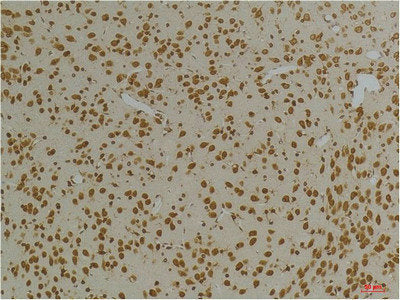 Immunohistochemical analysis of paraffin-embedded Rat BrainTissue using Kv10.1 Rabbit pAb diluted at 1:200.