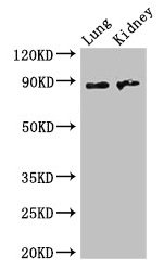 Western Blot Positive WB detected in: Mouse lung tissue, Mouse kidney tissue All lanes: NAALADL2 antibody at 3.5µg/ml Secondary Goat polyclonal to rabbit IgG at 1/50000 dilution Predicted band size: 89, 37 kDa Observed band size: 89 kDa