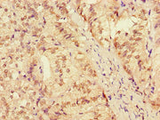Immunohistochemistry of paraffin-embedded human adrenal gland tissue using CSB-PA705058LA01HU at dilution of 1:100