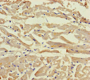 Immunohistochemistry of paraffin-embedded human heart tissue using CSB-PA705160LA01HU at dilution of 1:100