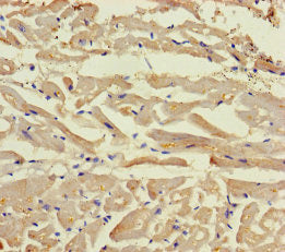 Immunohistochemistry of paraffin-embedded human heart tissue using CSB-PA705160LA01HU at dilution of 1:100