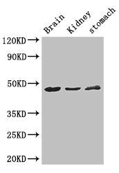 Western Blot Positive WB detected in: Mouse brain tissue, Mouse kidney tissue, Mouse stomach tissue All lanes: AGK antibody at 3ug/ml Secondary Goat polyclonal to rabbit IgG at 1/50000 dilution Predicted band size: 48, 8 kDa Observed band size: 48...