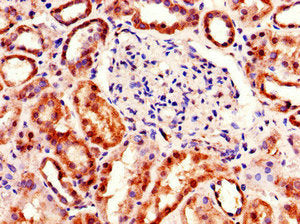 Immunohistochemistry of paraffin-embedded human kidney tissue using CSB-PA707440LA01HU at dilution of 1:100