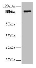 Western blot All lanes: FSCB antibody at 1.5µg/ml + Mouse liver tissue Secondary Goat polyclonal to rabbit IgG at 1/10000 dilution Predicted band size: 88 kDa Observed band size: 88 kDa