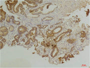 Immunohistochemical analysis of paraffin-embedded Human Prostate Tissue using Endothelin B ReceptorRabbit pAb diluted at 1:200.