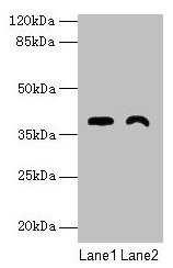 Western blot All lanes: TMEM255A antibody at 6µg/ml Lane 1: Mouse stomach tissue Lane 2: Mouse heart tissue Secondary Goat polyclonal to rabbit IgG at 1/10000 dilution Predicted band size: 39, 21, 36, 27 kDa Observed band size: 39 kDa