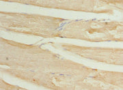 Immunohistochemistry of paraffin-embedded human skeletal muscle tissue using CSB-PA708487ESR1HU at dilution of 1:100