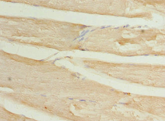 Immunohistochemistry of paraffin-embedded human skeletal muscle tissue using CSB-PA708487ESR1HU at dilution of 1:100
