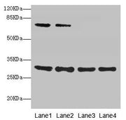 Western blot All lanes: SPIN3 antibody at 6µg/ml Lane 1: A549 whole cell lysate Lane 2: Hela whole cell lysate Lane 3: A431 whole cell lysate Lane 4: HepG2 whole cell lysate Secondary Goat polyclonal to rabbit IgG at 1/10000 dilution Predicted ban...