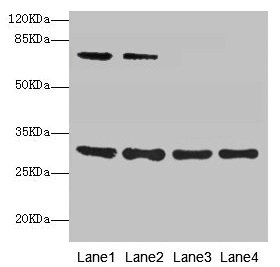 Western blot All lanes: SPIN3 antibody at 6µg/ml Lane 1: A549 whole cell lysate Lane 2: Hela whole cell lysate Lane 3: A431 whole cell lysate Lane 4: HepG2 whole cell lysate Secondary Goat polyclonal to rabbit IgG at 1/10000 dilution Predicted ban...