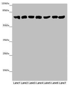 Western blot All lanes: EFHC1 antibody at 9.9 ug/ml Lane 1: Mouse large intestine tissue Lane 2: Mouse stomach tissue Lane 3: Mouse brain tissue Lane 4: Mouse kidney tissue Lane 5: Mouse gonadal tissue Lane 6: Hela whole cell lysate Lane 7: 293T w...