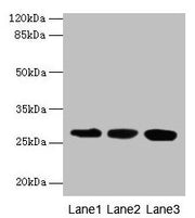 Western blot All lanes: KHDC1 antibody at 5µg/ml Lane 1: Mouse liver tissue Lane 2: Mouse kidney tissue Lane 3: Mouse gonadal tissue Secondary Goat polyclonal to rabbit IgG at 1/10000 dilution Predicted band size: 28, 19 kDa Observed band size: 28...