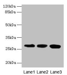 Western blot All lanes: KHDC1 antibody at 5µg/ml Lane 1: Mouse liver tissue Lane 2: Mouse kidney tissue Lane 3: Mouse gonadal tissue Secondary Goat polyclonal to rabbit IgG at 1/10000 dilution Predicted band size: 28, 19 kDa Observed band size: 28...