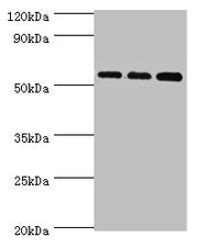 Western blot All lanes: Acyl-coenzyme A synthetase ACSM3, mitochondrial antibody at 10ug/ml Lane 1: 293T whole cell lysate Lane 2: Mouse kidney tissue Lane 3: A431 whole cell lysate Secondary Goat polyclonal to rabbit IgG at 1/10000 dilution Predi...