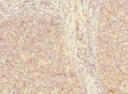 Immunohistochemistry of paraffin-embedded human tonsil tissue using CSB-PA711356LA01HU at dilution of 1:100