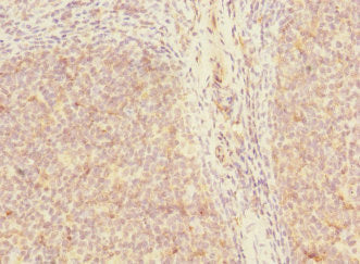 Immunohistochemistry of paraffin-embedded human tonsil tissue using CSB-PA711356LA01HU at dilution of 1:100