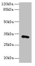 Western blot All lanes: FAM78A antibody at 0.2µg/ml + HepG2 whole cell lysate Secondary Goat polyclonal to rabbit IgG at 1/10000 dilution Predicted band size: 32 kDa Observed band size: 32 kDa