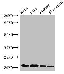 Western Blot Positive WB detected in: Hela whole cell lysate, Mouse lung tissue, Mouse kidney tissue, Human placenta tissue All lanes: KRBOX4 antibody at 3.4µg/ml Secondary Goat polyclonal to rabbit IgG at 1/50000 dilution Predicted band size: 21,...