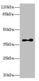 Western blot All lanes: CLVS2 antibody at 16µg/ml + Mouse brain tissue Secondary Goat polyclonal to rabbit IgG at 1/10000 dilution Predicted band size: 38, 22 kDa Observed band size: 38 kDa