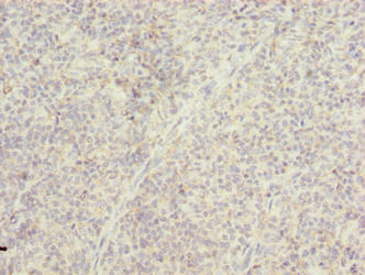 Immunohistochemistry of paraffin-embedded human tonsil tissue using CSB-PA713124LA01HU at dilution of 1:100