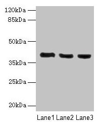 Western blot All lanes: C9orf64 antibody at 1µg/ml Lane 1: Hela whole cell lysate Lane 2: K562 whole cell lysate Lane 3: HepG2 whole cell lysate Secondary Goat polyclonal to rabbit IgG at 1/10000 dilution Predicted band size: 40 kDa Observed band...
