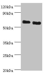 Western blot All lanes: ATAD3B antibody at 2ug/ml Lane 1: Jurkat whole cell lysate Lane 2: Hela whole cell lysate Secondary Goat polyclonal to rabbit IgG at 1/10000 dilution Predicted band size: 73, 20, 68 kDa Observed band size: 73 kDa