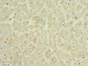 Immunohistochemistry of paraffin-embedded human heart tissue using CSB-PA713139LA01HU at dilution of 1:100