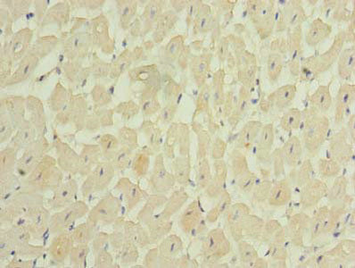 Immunohistochemistry of paraffin-embedded human heart tissue using CSB-PA713139LA01HU at dilution of 1:100