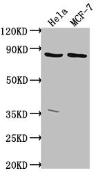 Western Blot Positive WB detected in: Hela whole cell lysate, MCF-7 whole cell lysate All lanes: TTC39B antibody at 1:2000 Secondary Goat polyclonal to rabbit IgG at 1/50000 dilution Predicted band size: 77, 67, 76, 60, 70, 23 kDa Observed band si...