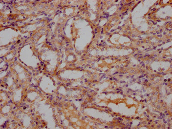 IHC image of CSB-PA714125OA01RA diluted at 1:300 and staining in paraffin-embedded Rat kidney tissue performed on a Leica BondTM system. After dewaxing and hydration, antigen retrieval was mediated by high pressure in a citrate buffer (pH 6.0). Se...