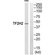 Western blot analysis of extracts from COLO205 cells, using TF2H2 antibody.