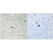 Immunohistochemistry analysis of paraffin-embedded human brain tissue using VEGFR1 antibody.