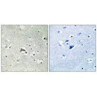 Immunohistochemistry analysis of paraffin-embedded human brain tissue using VEGFR1 antibody.