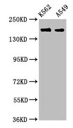 Western Blot Positive WB detected in: K562 whole cell lysate, A549 whole cell lysate All lanes: FMN1 antibody at 3.9µg/ml Secondary Goat polyclonal to rabbit IgG at 1/50000 dilution Predicted band size: 158, 72, 54, 133 kDa Observed band size: 158...