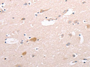 The image on the left is immunohistochemistry of paraffin-embedded Human brain tissue using CSB-PA715372(CIDEB Antibody) at dilution 1/50, on the right is treated with fusion protein. (Original magnification: ×200)