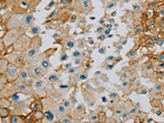 The image on the left is immunohistochemistry of paraffin-embedded Human prostate cancer tissue using CSB-PA715783(SERINC1 Antibody) at dilution 1/40, on the right is treated with synthetic peptide. (Original magnification: ×200)