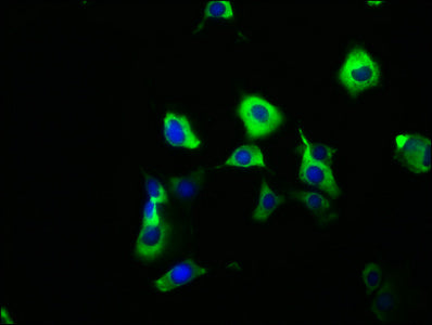 Immunofluorescence staining of MCF-7 cells with CSB-PA716356LA01HU at 1:166, counter-stained with DAPI. The cells were fixed in 4% formaldehyde, permeabilized using 0.2% Triton X-100 and blocked in 10% normal Goat Serum. The cells were then incuba...