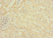Immunohistochemistry of paraffin-embedded human liver tissue using CSB-PA716402LA01HU at dilution of 1:100