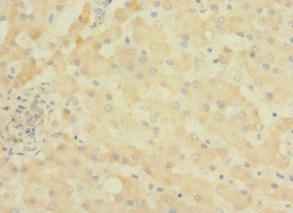 Immunohistochemistry of paraffin-embedded human liver tissue using CSB-PA716402LA01HU at dilution of 1:100