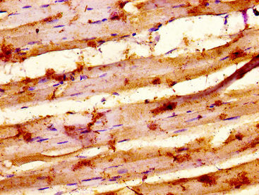 IHC image of CSB-PA716576LA01HU diluted at 1:500 and staining in paraffin-embedded human skeletal muscle tissue performed on a Leica BondTM system. After dewaxing and hydration, antigen retrieval was mediated by high pressure in a citrate buffer (...